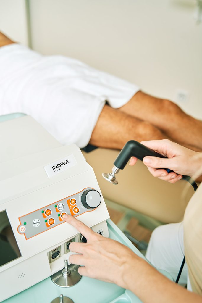 fisioterapia con indiba para el sindrome de la pedrada